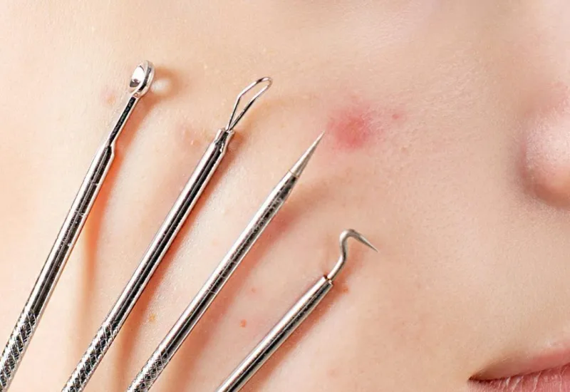 Penyebab berbagai permasalahan kulit bisa hilang dengan cara skin booster.(Foto: Pexels)